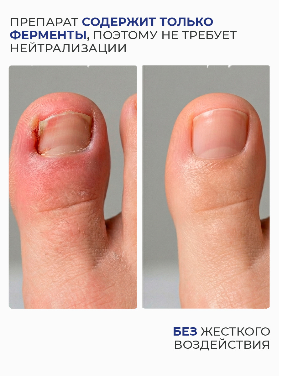 Дизайн ногтей. Товар: Rosilak, ENZYME размягчающая гель-сыворотка для ногтей и кожи, 25 мл