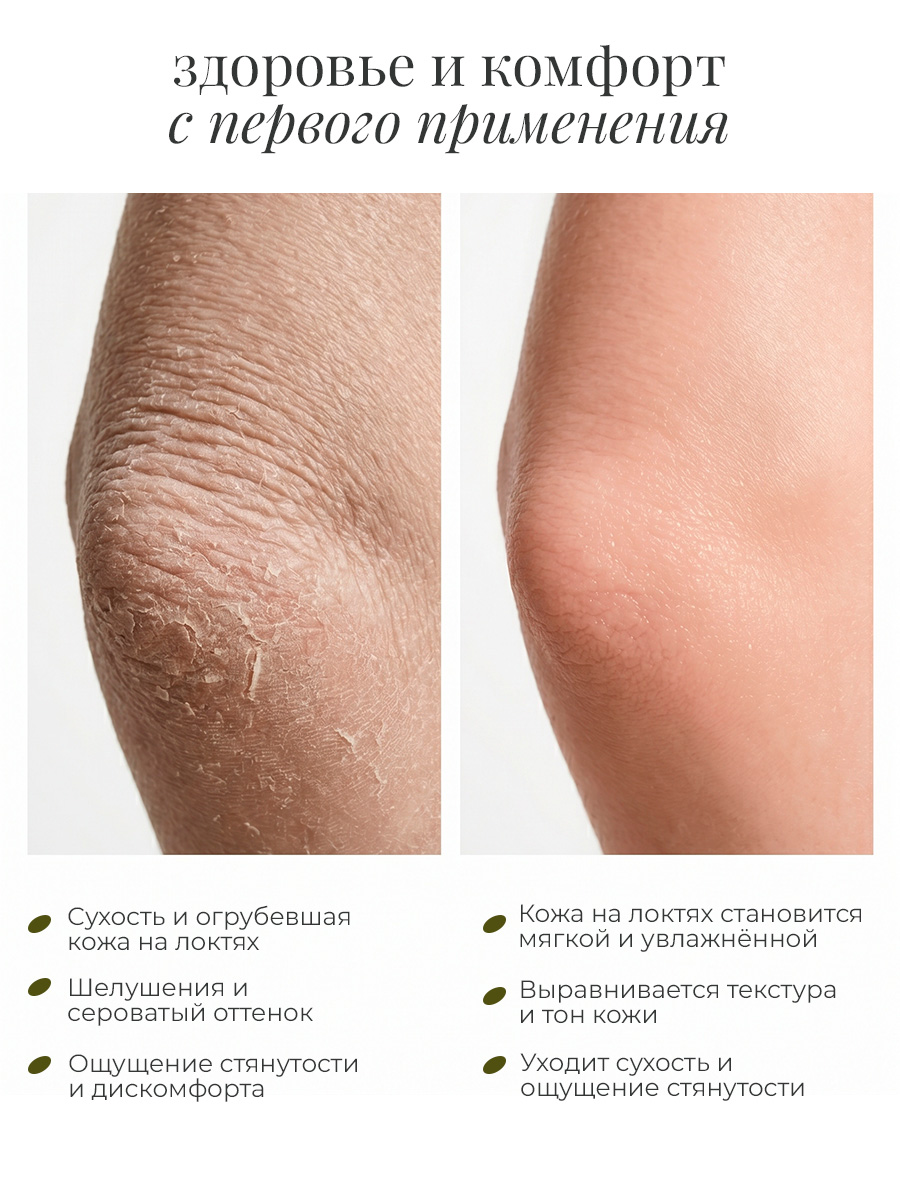 Дизайн ногтей. Товар: Rosilak, крем-маска "Helper" - SOS – при псориазе, трещинах на пятках, 50 мл