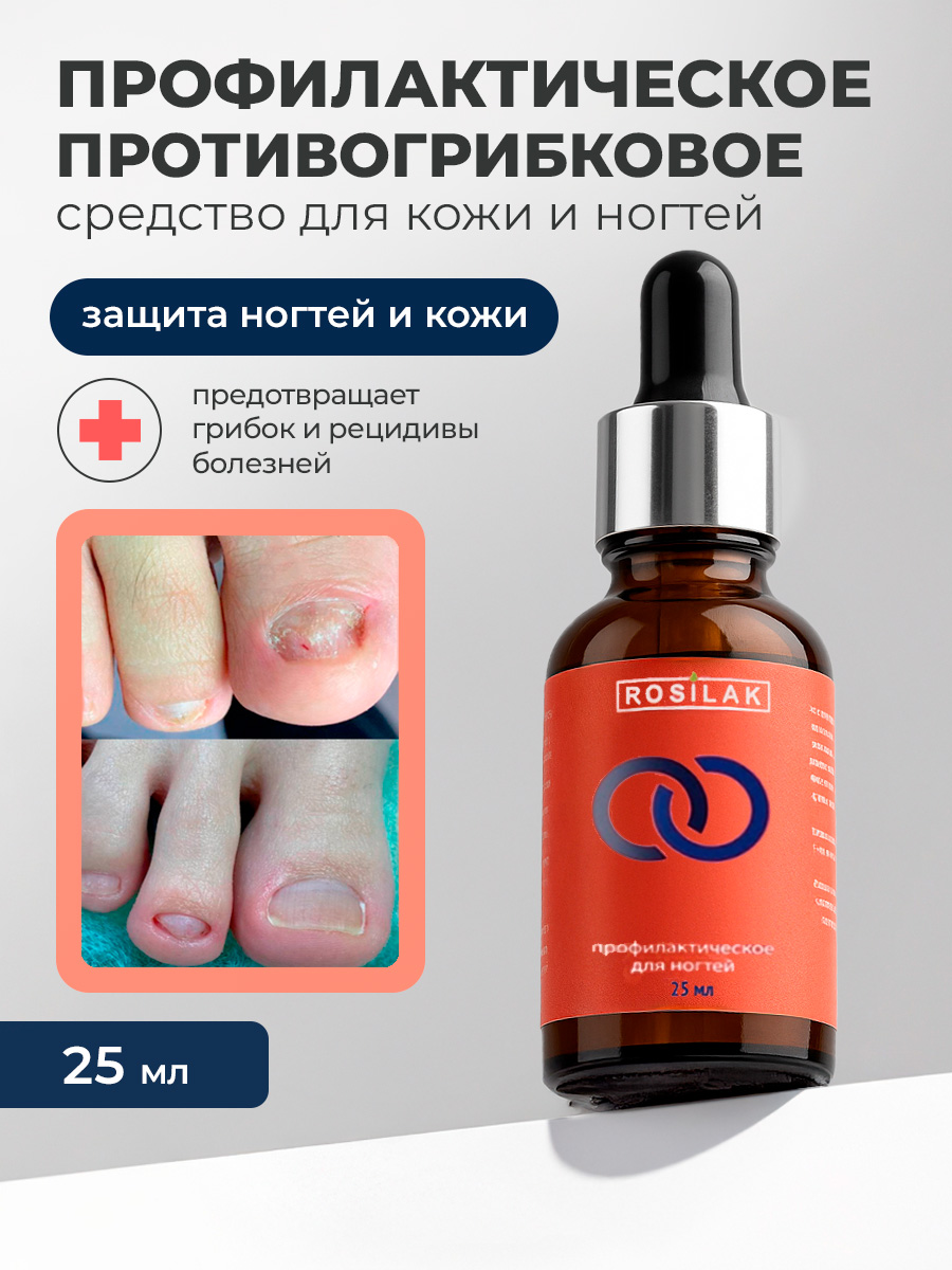 Rosilak, PROFIT профилактическое противогрибковое средство, 25 мл Rosilak, PROFIT профилактическое противогрибковое средство, 25 мл