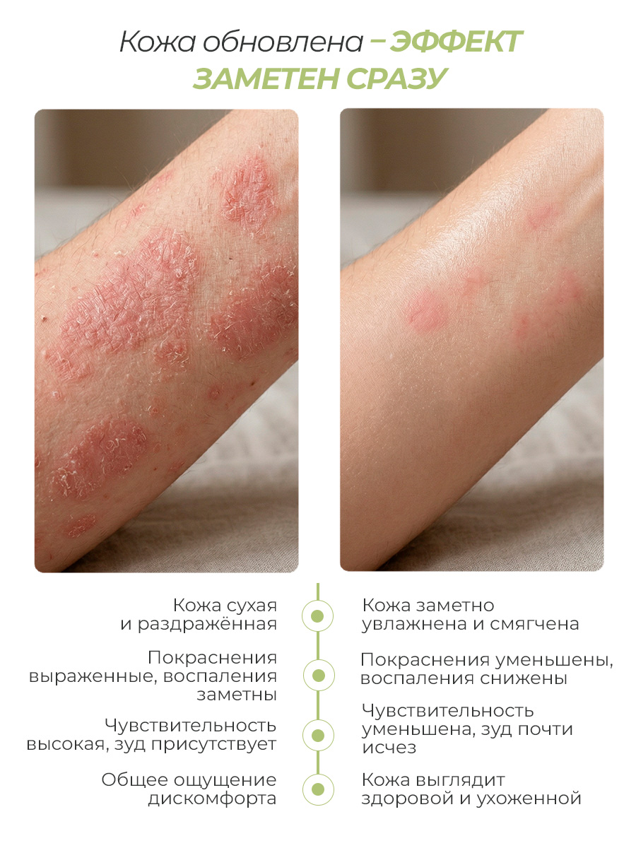 Дизайн ногтей. Товар: Rosilak, Aqskin - крем-эмолент увлажняющий для ног, 100 мл