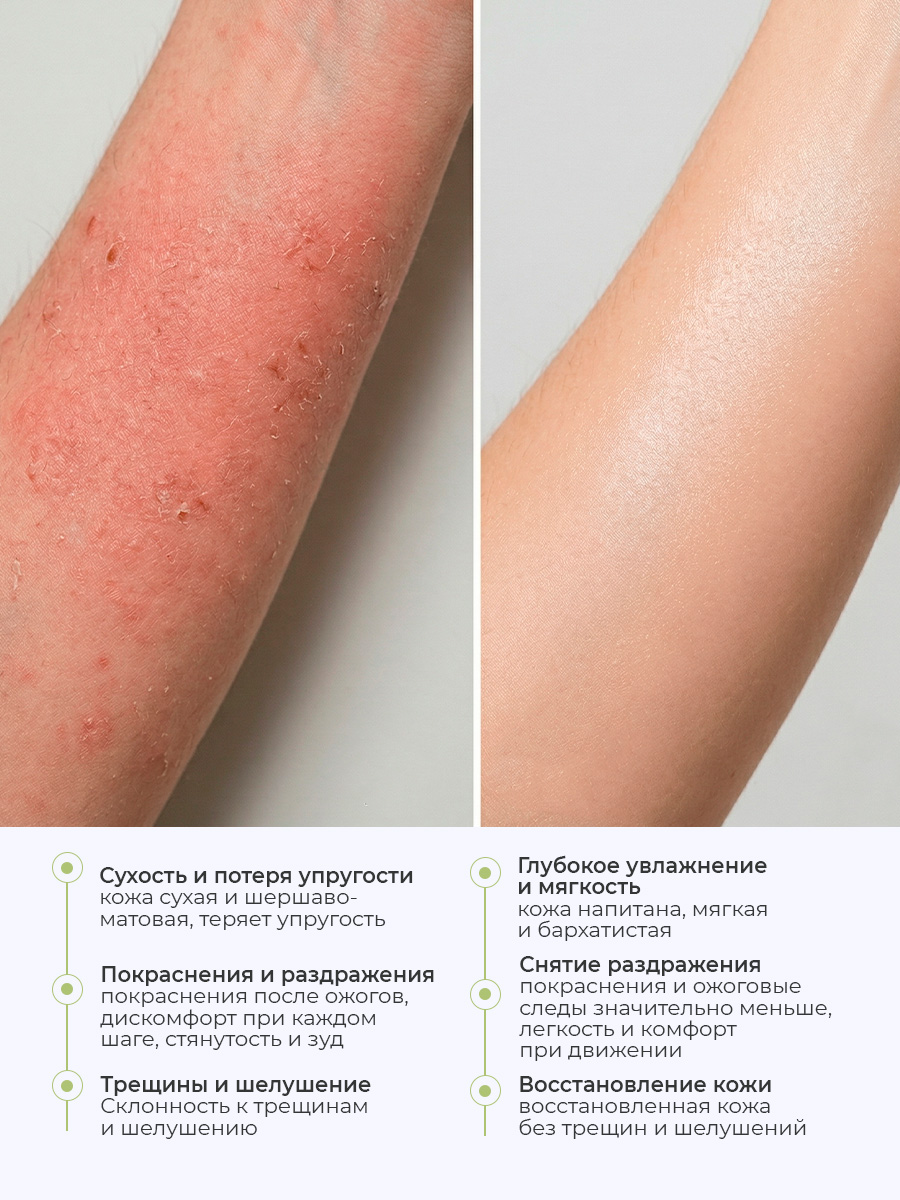 Дизайн ногтей. Товар: Rosilak, Aqskin - крем-эмолент увлажняющий для ног, 100 мл