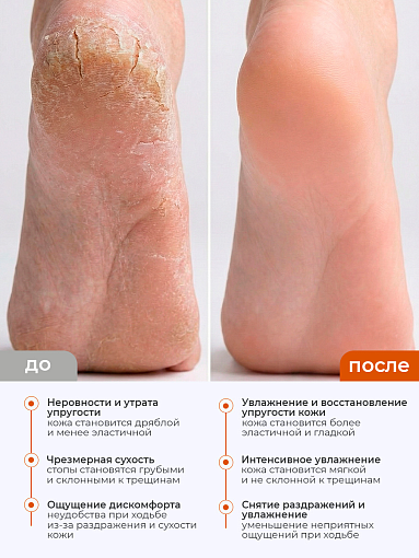 Rosilak, набор №29 пенка очищающая, масло-спрей для кожи, пенка-кератолитик для педикюра