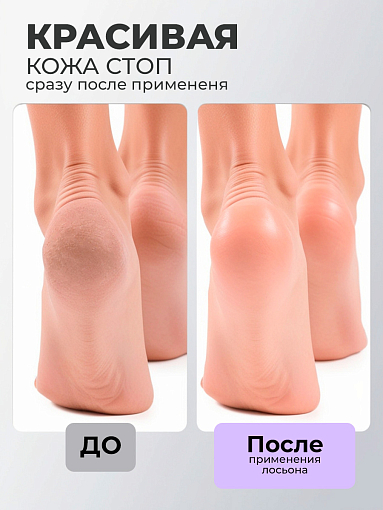 МультиДез, Тефлекс А Мастер - лосьон №1 для размягчения и очищения кожи и ногтей, 100 мл