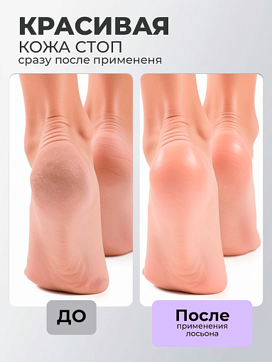 МультиДез, Тефлекс А Мастер - лосьон №2 для размягчения кутикулы и подногтевых мозолей, 100 мл