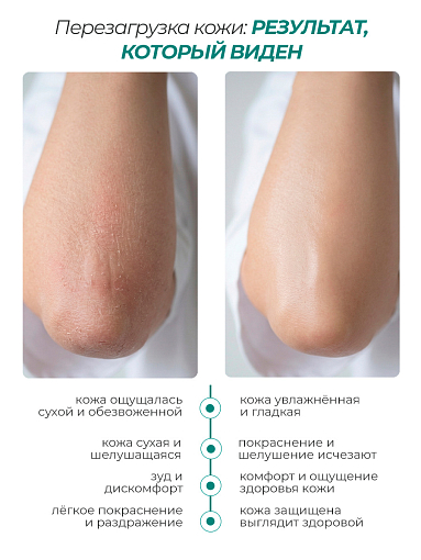 Rosilak, FOTODIN - гель косметический с хлорофиллом, 50 мл