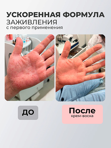 Rosilak, крем воск от дерматита, 50 мл