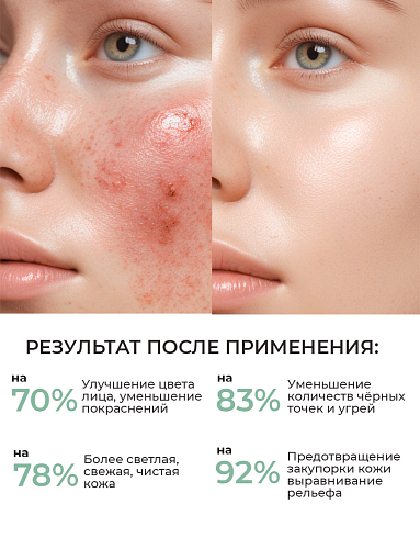 ФармКосметик / Livsi - пенка для умывания с щёточкой cleansing FOAM with PHA AHA BHA, 180 мл