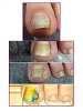 Rosilak, ENZYME - размягчающая гель-сыворотка для ногтей и кожи, 25 мл