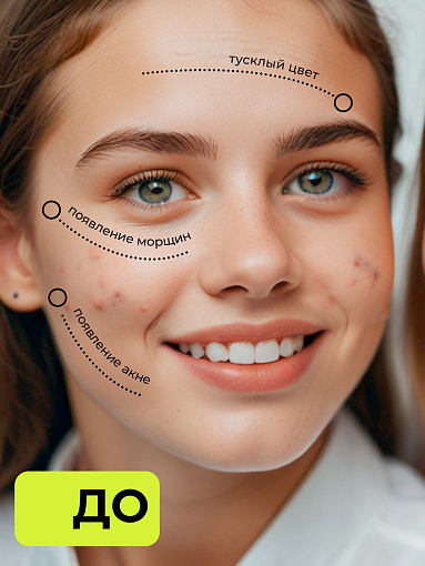 Микс набор №31 крем-маска "Helper"при псориазе и трещинах на пятках, масло монарды