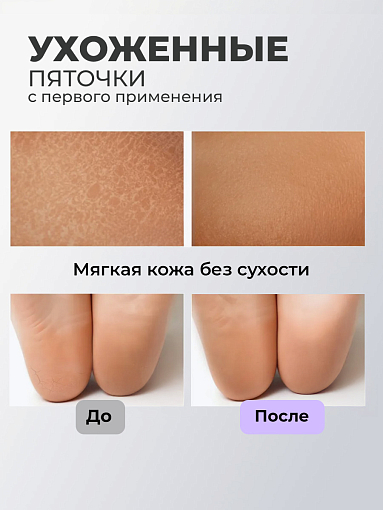 Rosilak, MAGIC PODO - гель размягчающий для обработки ногтей и кожи, 50 мл
