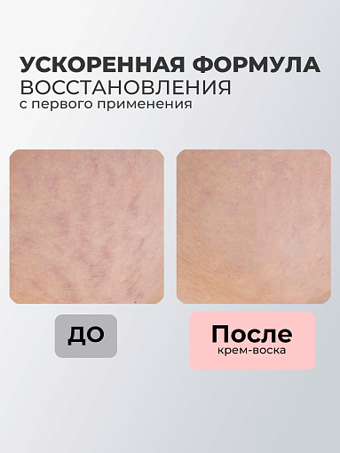 Rosilak, крем воск от шрамов и рубцов, 50 мл