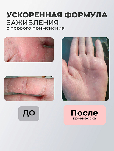 Rosilak, крем воск для очень сухой кожи и шелушений, 50 мл