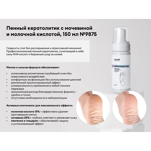 RuNail, пенный кератолитик для кожи стоп с мочевиной и молочной кислотой, 150 мл