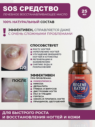 Rosilak, REGENERATOR - средство от аллергического дерматита и онихолизиса, 25 мл