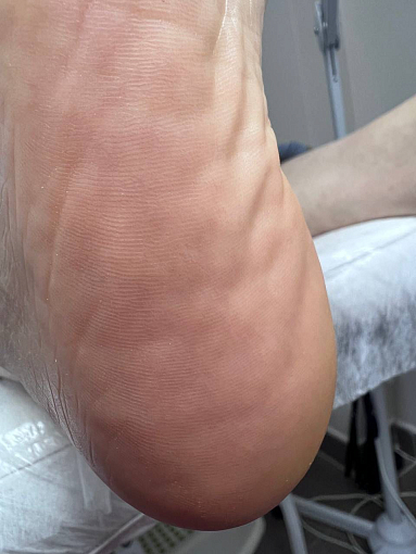 Rosilak, SPA peeling - гель-пилинг для кожи, 250 мл