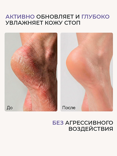 Irisk, PureFeet Cream Stick - защищающий крем-стик для ухода за кожей стоп, локтей и рук, 36 гр