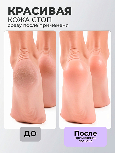 МультиДез, Тефлекс А Мастер - лосьон №3 для размягчения ороговевшей кожи, 100 мл
