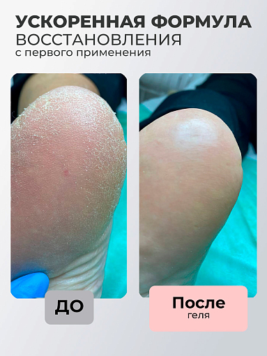 Rosilak, SPA peeling - гель-пилинг для кожи, 250 мл