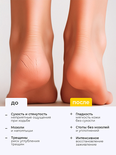 МультиДез, Тефлекс А Мастер - увлажняющий мусс для ног с антисептическим эффектом, 200 мл