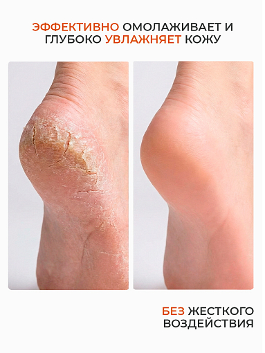 Rosilak, Stimul peel пенка-кератолитик для педикюра, 160 мл