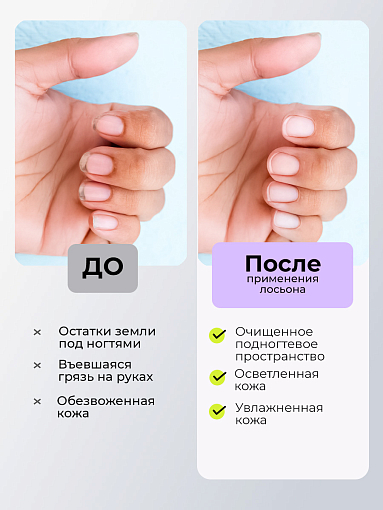 МультиДез, Тефлекс А Мастер - лосьон №1 для размягчения и очищения кожи и ногтей, 100 мл