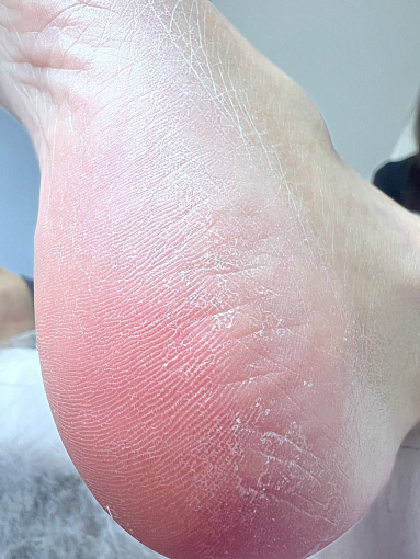 Rosilak, SPA peeling - гель-пилинг для кожи, 250 мл