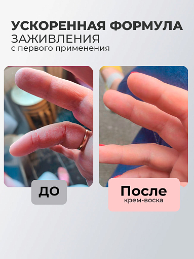 Rosilak, крем воск для очень сухой кожи и шелушений, 50 мл