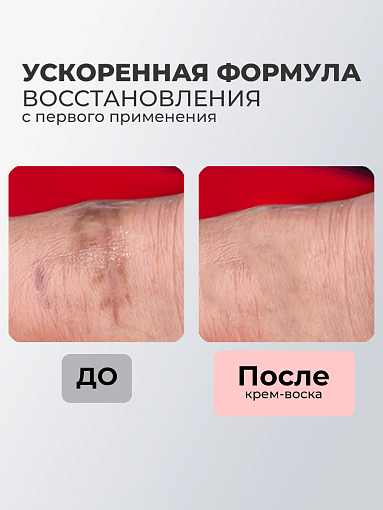 Rosilak, крем воск от шрамов и рубцов, 50 мл