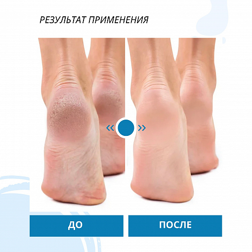 ФармКосметик / Livsi, кератолическая пенка для ног, 180 мл