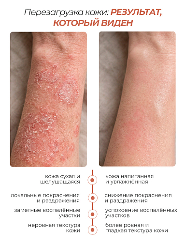 Rosilak, крем Regenerator "Кофе", 50 мл