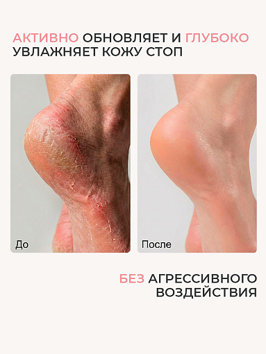 Irisk, PureFeet Cream Stick - увлажняющий крем-стик для ухода за кожей стоп, локтей и рук, 36 гр