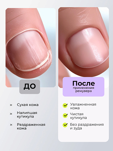 Irisk, Menthol Cuticle Remover - средство для удаления кутикулы с ментолом, 100 мл