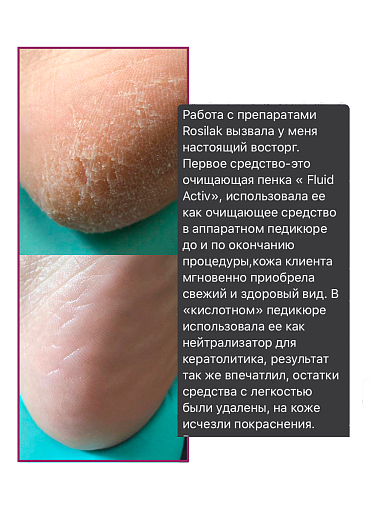 УЦЕНКА, Rosilak, FLUID ACTIVE - пенка очищающая с ионами серебра, 160 мл