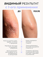 Irisk, PureFeet Cream Stick - защищающий крем-стик для ухода за кожей стоп, локтей и рук, 36 гр
