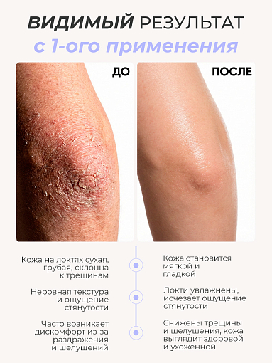 Irisk, PureFeet Cream Stick - защищающий крем-стик для ухода за кожей стоп, локтей и рук, 36 гр