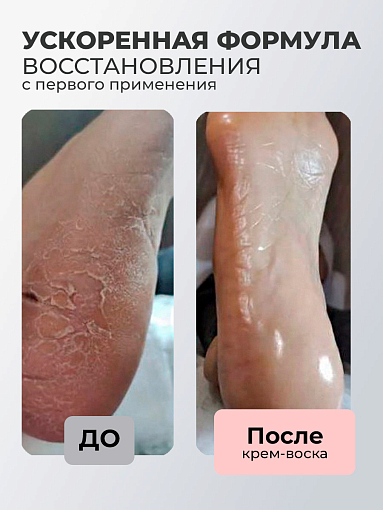 Микс набор №20 крем-маска "Helper"- SOS - при псориазе, сыворотка двухфазная для ногтей
