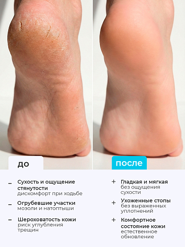 ФармКосметик / Livsi, кератолическая пенка для ног, 180 мл