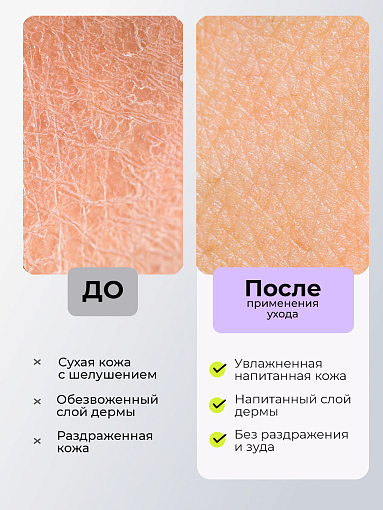 RuNail, варежки косметические №1473 (белые), 2 шт
