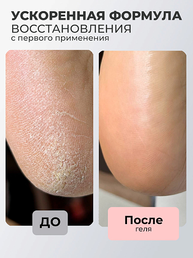 Rosilak, SPA peeling - гель-пилинг для кожи, 250 мл