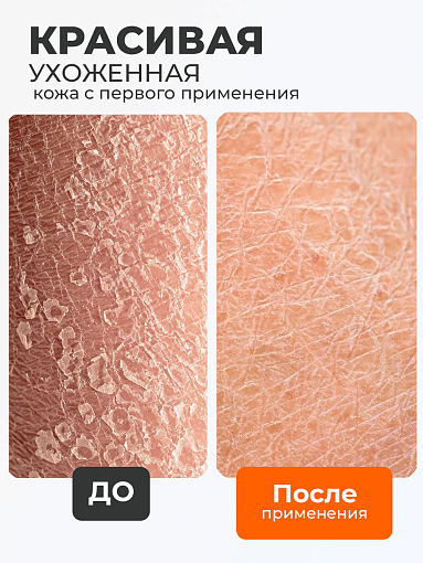 Butterfly "чудо"-мочалка рукавица (трехфункциональная, средняя 22x12см)