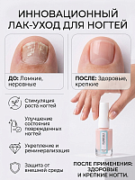 PureFeet, лак-уход для педикюра с тербинафином №001, 10 мл