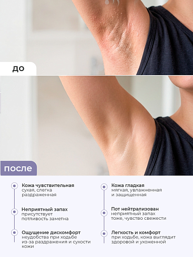 Rosilak, Ekzogidroz - крем для тела от потливости и запаха, 50 мл