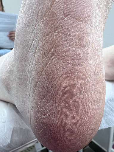 Rosilak, SPA peeling - гель-пилинг для кожи, 250 мл