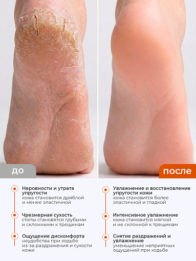 Rosilak, Stimul peel пенка-кератолитик для педикюра, 160 мл