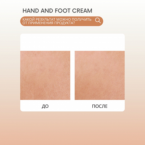 ФармКосметик / Livsi, крем для кожи рук и ног UREA25% (папайя и макадамия), 200 мл